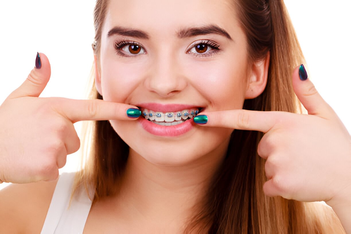 Braces in Aberdeen