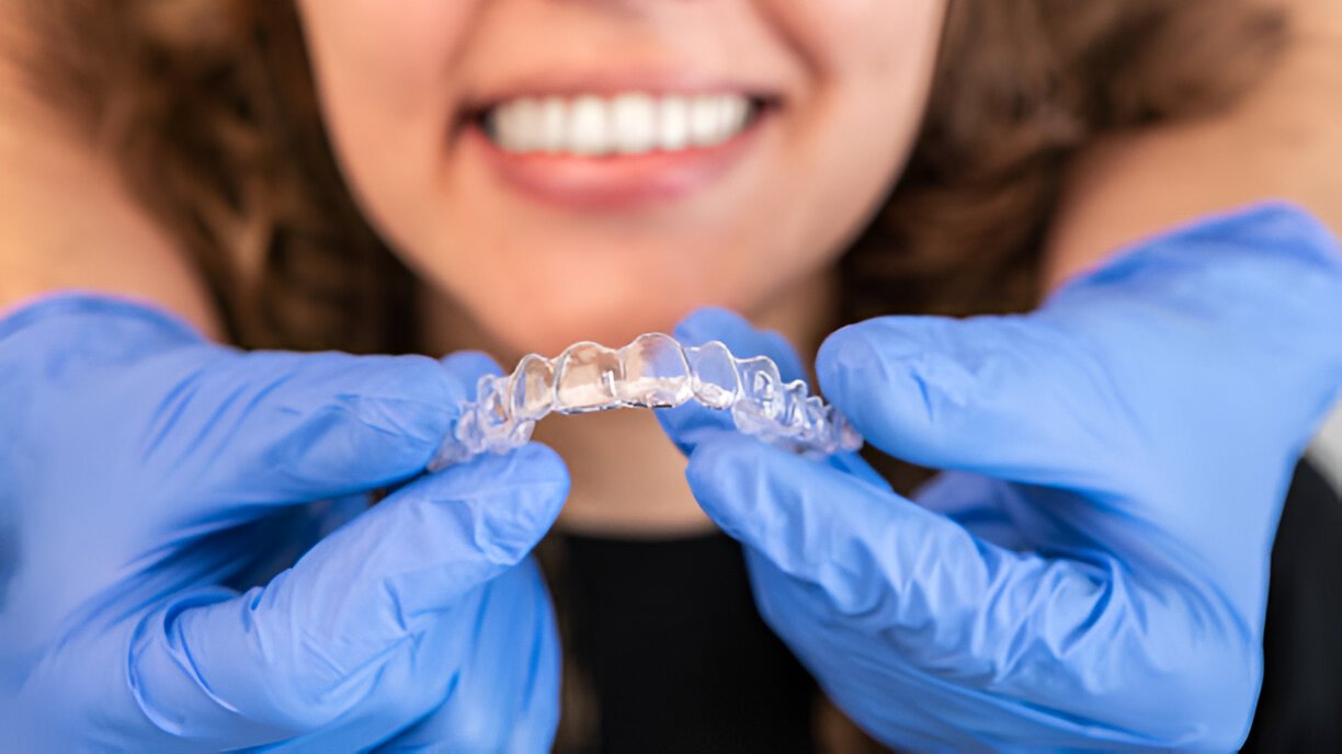 Invisalign Treatment in Aberdeen