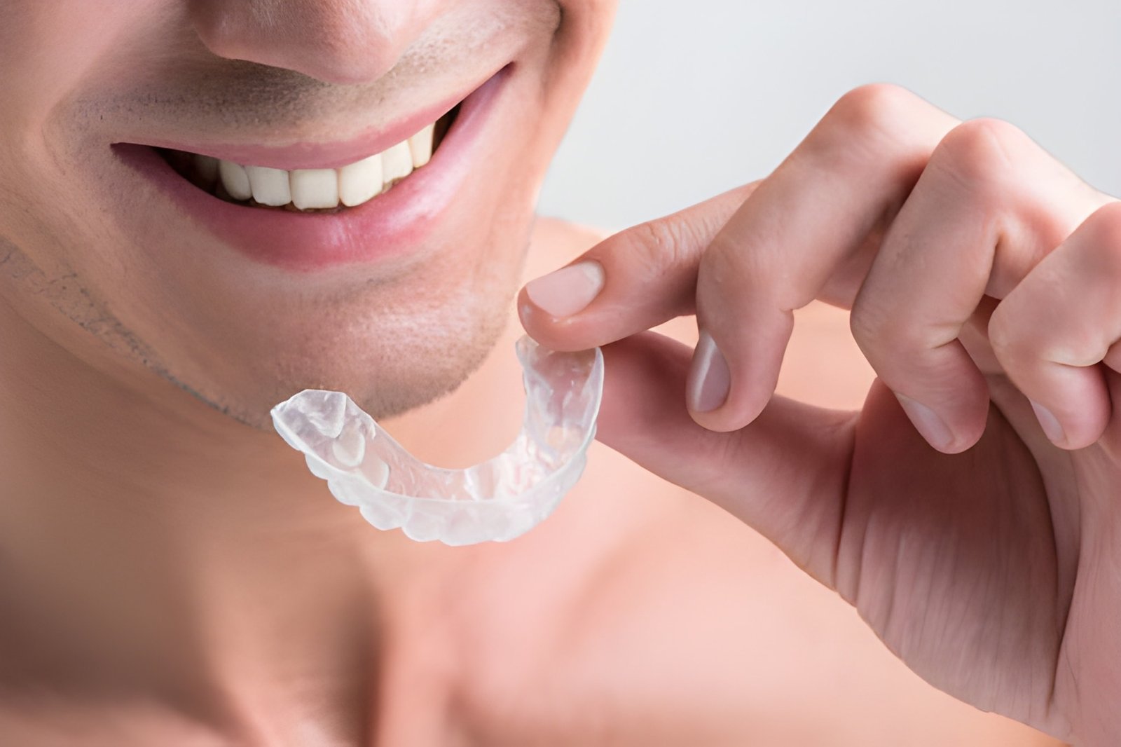 Invisalign
