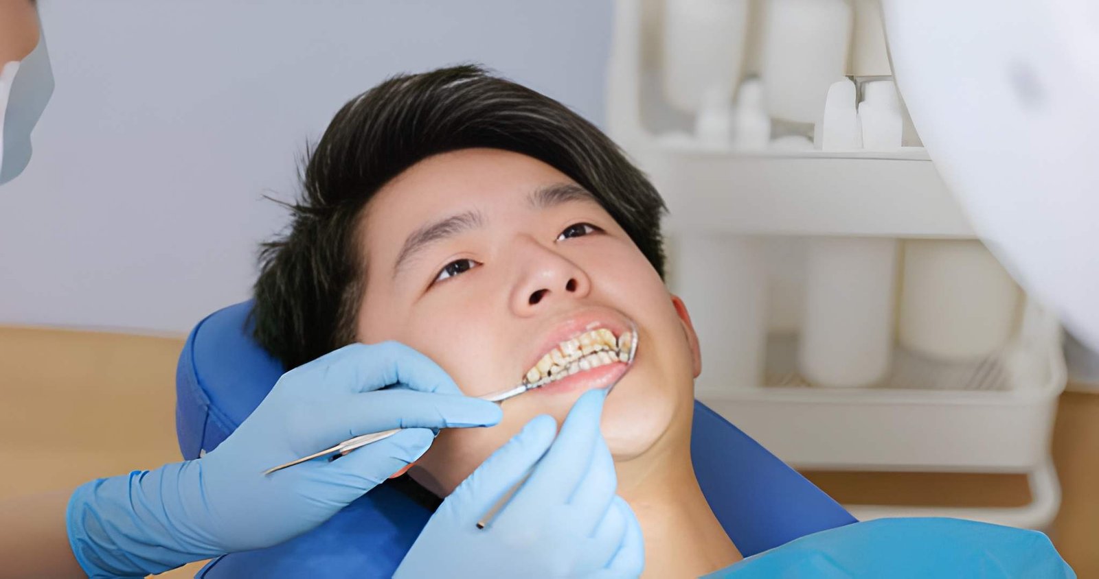 Can Braces Correct Jaw Alignment and Crooked Teeth?