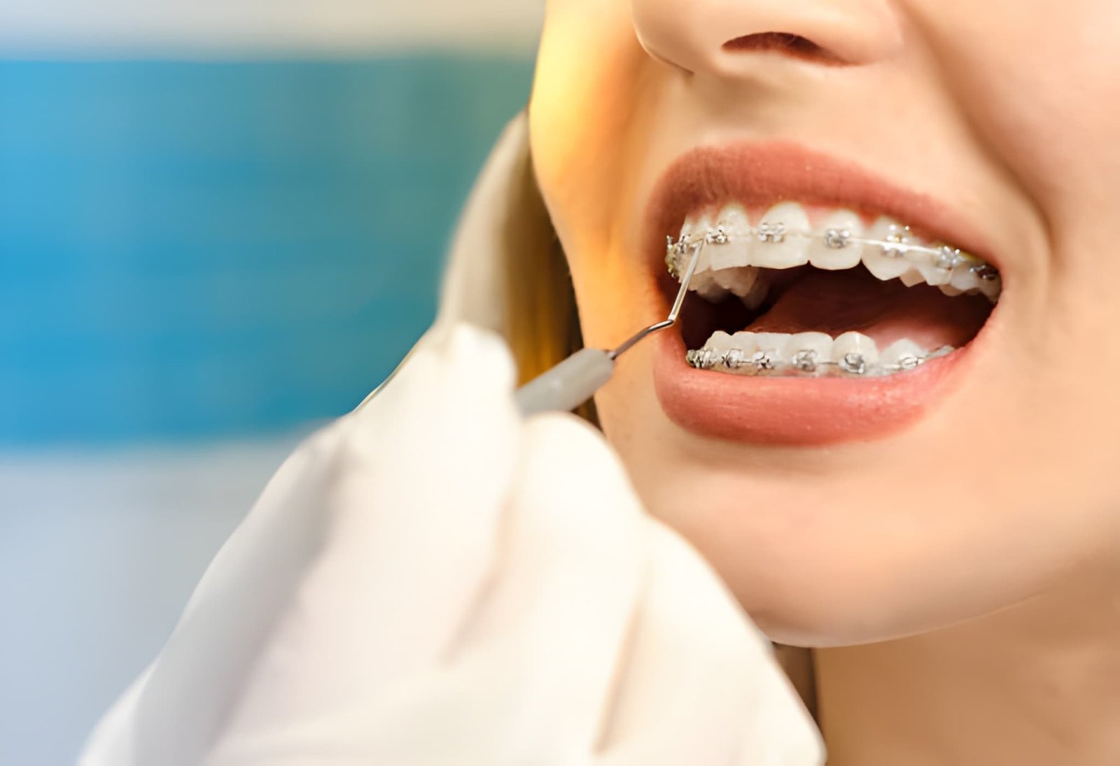 Braces Treatment in Aberdeen
