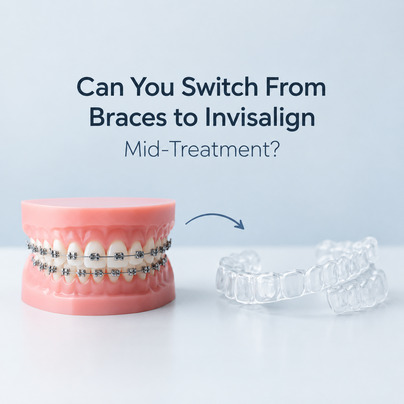 Switch from braces to invisalign